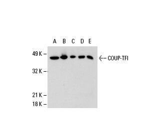 western blotting image from recommended COUP-TFI (H-11) monoclonal antibody replacement. Image 20471