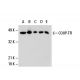 western blotting image from recommended COUP-TFI (H-11) monoclonal antibody replacement. Image 20471