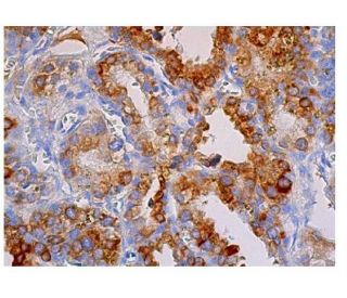 Cox-2 Antibody (29) - Immunohistochemistry - Image 348785 