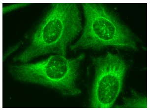 Cox-2 Antibody (H-3) | SCBT - Santa Cruz Biotechnology