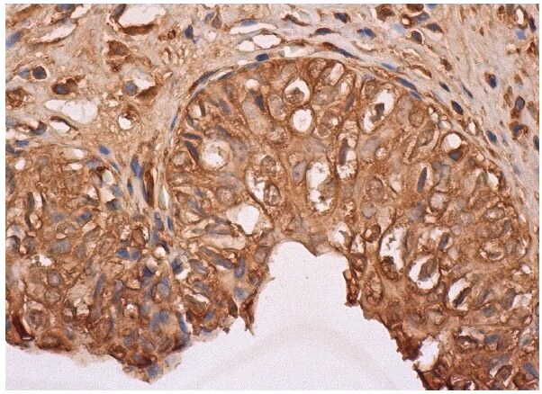 Cox-2 Antibody (H-3) | SCBT - Santa Cruz Biotechnology Cox-2 Antibody (H-3) | SCBT - Santa Cruz Biotechnology