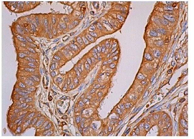 Cox-2 Antibody (H-3) | SCBT - Santa Cruz Biotechnology Cox-2 Antibody (H-3) | SCBT - Santa Cruz Biotechnology