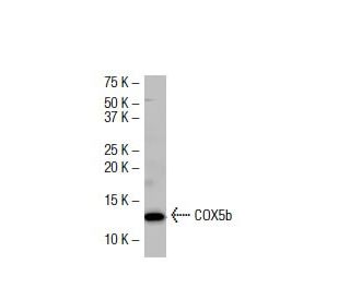 COX5b Antibody (W10) - Western Blotting - Image 33897 