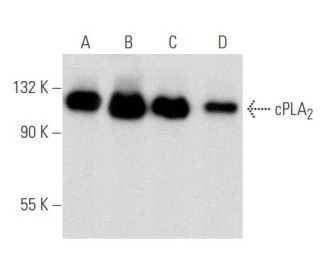 western blotting image from recommended cPLA2 (4-4B-3C) monoclonal antibody replacement. Image 354723