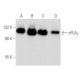 western blotting image from recommended cPLA2 (4-4B-3C) monoclonal antibody replacement. Image 354723