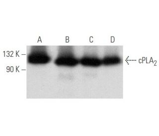 cPLA<sub>2 Antibody (</sub>E-1) - Western Blotting - Image 354724 