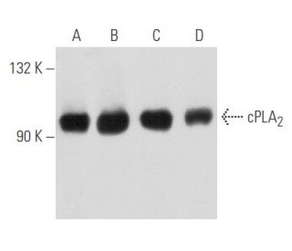cPLA<sub>2 Antibody (</sub>H-12) - Western Blotting - Image 354735 