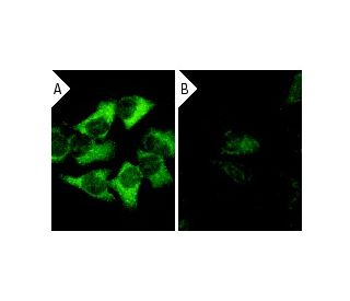 cPLA<sub>2</sub> siRNA (h): sc-29280. Immunofluorescence staining of methanol-fixed, control HeLa (A) and cPLA<sub>2</sub> 