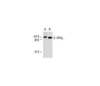 cPLA<sub>2</sub> Antibody (4-4B-3C) - Western Blotting - Image 3783