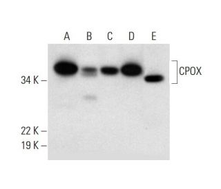 CPOX Antibody (B-9) - Western Blotting - Image 294820 