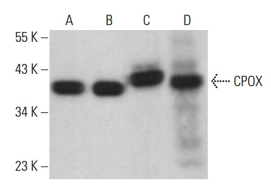 CPOX Antibody (B-9) | SCBT - Santa Cruz Biotechnology