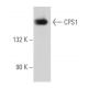 This polyclonal antibody has been discontinued. See our recommended <a href="cps1-antibody-b-1">CPS1 (B-1)</a> monoclonal antibody (sample data shown). western blotting image from recommended CPS1 (B-1) monoclonal antibody replacement. Image 356728