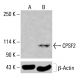 CPSF2 Antibody (A-6) - Western Blotting - Image 415476
