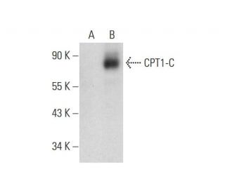 CPT1-C Antibody (B-1) - Western Blotting - Image 323829 
