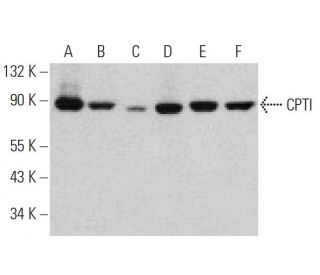 CPTI Antibody (E-7) - Western Blotting - Image 359943 