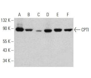 western blotting image from recommended CPTI (E-7) monoclonal antibody replacement. Image 359943