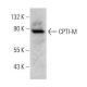 CPTI-M Antibody (D-8) - Western Blotting - Image 358676