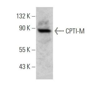 CPTI-M Antibody (D-8) - Western Blotting - Image 358676The Double Nickase Plasmid features a U6 promoter for sgRNA expression, a 20 nt targeting sequence, and a gRNA scaffold to guide Cas9n. It includes a CBh promoter for Cas9n (D10A) and puromycin resistance, GFP for transfection verification, and nuclear localization signals (NLS). The 2A peptide allows co-expression of Cas9n and Puro from a single promoter, enabling precise genome editing with reduced off-target effects.