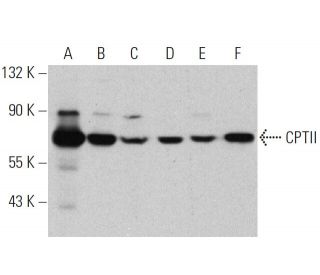 western blotting image from recommended CPTII (G-5) monoclonal antibody replacement. Image 359954