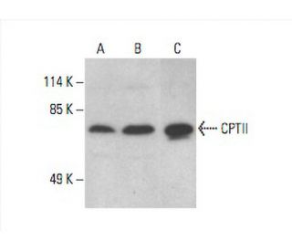 CPTII Antibody (G-5) - Western Blotting - Image 393077