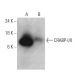 Este anticuerpo policlonal ha dejado de fabricarse. Consulta nuestro anticuerpo monoclonal recomendado <a href="crabp-i-ii-antibody-f-9">CRABP-I/II (F-9)</a> (se muestran datos de muestra). western blotting image from recommended CRABP-I/II (F-9) monoclonal antibody replacement. Image 358706