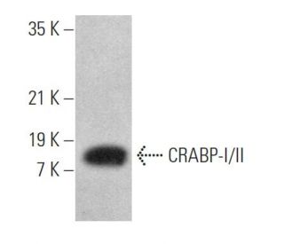 CRABP-I/II Antibody (F-9) - Western Blotting - Image 371589