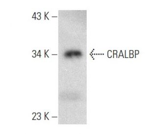 western blotting image from recommended CRALBP (G-9) monoclonal antibody replacement. Image 357262