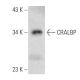 western blotting image from recommended CRALBP (G-9) monoclonal antibody replacement. Image 357262
