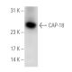 western blotting image from recommended CAP-18 (G-1) monoclonal antibody replacement. Image 65619