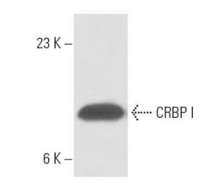 CRBP I Antibody (F3) - Western Blotting - Image 15521 