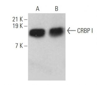 western blotting image from recommended CRBP I (B-8) monoclonal antibody replacement. Image 359358