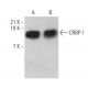 western blotting image from recommended CRBP I (B-8) monoclonal antibody replacement. Image 359358