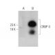 CRBP II Antibody (8-1#) - Western Blotting - Image 374583