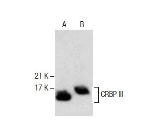 CRBP III Antibody (A-12) - Western Blotting - Image 287491 