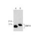 CRBP III Antibody (A-12) - Western Blotting - Image 287491 