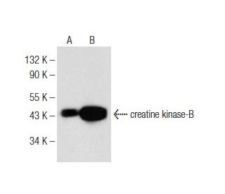 Creatine Kinase-B抗体 (B-9) | SCBT - Santa Cruz Biotechnology