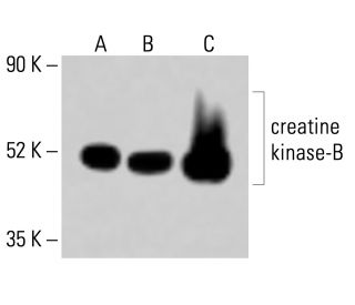 creatine kinase-B Antibody (B-9) - Western Blotting - Image 414432 