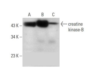 creatine kinase-B Antibody (G-6) - Western Blotting - Image 296250 