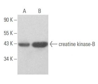 western blotting image from recommended creatine kinase-B (B-9) monoclonal antibody replacement. Image 356117