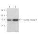 western blotting image from recommended creatine kinase-B (B-9) monoclonal antibody replacement. Image 356117