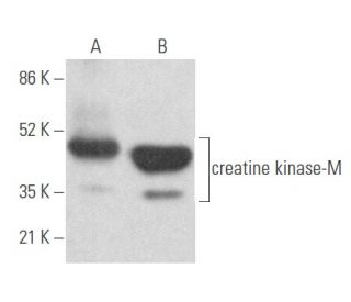 western blotting image from recommended creatine kinase-M (G-9) monoclonal antibody replacement. Image 355609