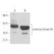 western blotting image from recommended creatine kinase-M (G-9) monoclonal antibody replacement. Image 355609