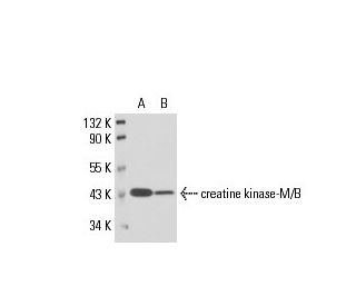 western blotting image from recommended creatine kinase-M/B (1.BB.105) monoclonal antibody replacement. Image 17571