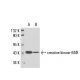 western blotting image from recommended creatine kinase-M/B (1.BB.105) monoclonal antibody replacement. Image 17571