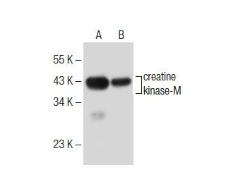 creatine kinase-M Antibody (B-1) - Western Blotting - Image 285396