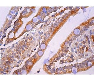 CREB3L3 Antibody (G-11) - Immunohistochemistry - Image 380114 