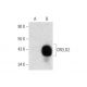 CRELD2 Antibody (A-8) - Western Blotting - Image 138432 