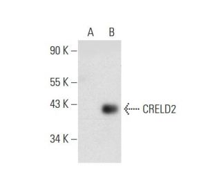 CRELD2 Antibody (C-7) - Western Blotting - Image 137561Each CRISPR/Cas9 Knockout (KO) Plasmid product consists of a pool of 3 plasmids designed to ensure identification and cleavage of a specific gene for maximum knockout efficiency. Each plasmid encodes a unique 20 nt sequence derived from the GeCKO (v2) library.