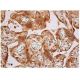 CREM Antibody (22) - Immunohistochemistry - Image 352262
