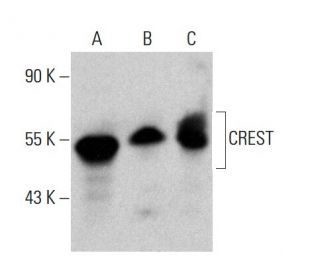 CREST Antibody (D-7) - Western Blotting - Image 376866 